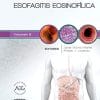 Esofagitis eosinofílica: Clínicas Iberoamericanas de Gastroenterología y Hepatología (Spanish Edition) (True PDF)