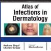 Atlas of Infections in Dermatology (PDF)