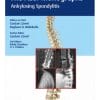 The ASSI Monographs: Ankylosing Spondylitis (PDF)