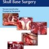 Atlas of 360 degrees Skull Base Surgery (PDF)