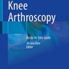 Knee Arthroscopy: An Up-to-Date Guide (PDF)
