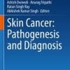 Skin Cancer: Pathogenesis and Diagnosis (PDF)