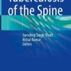 Tuberculosis of the Spine (PDF)