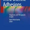 Intra Uterine Adhesions: Diagnostic and Therapeutic Insight (PDF)