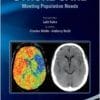 A Practical Guide to Comprehensive Stroke Care: Meeting Population Needs (PDF)