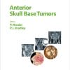 Anterior Skull Base Tumors (Advances in Oto-Rhino-Laryngology, Vol. 84) (PDF)