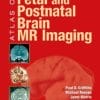 Atlas of Fetal and Postnatal Brain MR Imaging