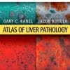 Atlas of Liver Pathology: Expert Consult – Online and Print, 3rd