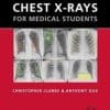 Chest X-rays for Medical Students 1st Edition