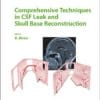 Comprehensive Techniques in Cerebrospinal Fluid Leak and Skull Base Reconstruction