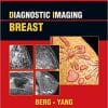 Diagnostic Imaging: Breast, 2nd ed: Published by Amirsys Second Edition