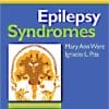Epilepsy Syndromes: Expert Consult – Online, Print, and DVD, 1e 1 Har/Dol/ Edition