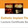 gIDE Esthetic Implant Therapy (12 Lecture Series)