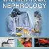 Interventional Nephrology (PDF)