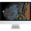 Breast Imaging Pearls and Pitfalls: Traditional and Novel Imaging Approaches 2020 (CME VIDEOS)
