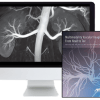 Multimodality Vascular Imaging: From Head to Toe 2020 (CME VIDEOS)