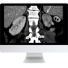 Abdominal and Thoracic Imaging Guidelines Applied: Evidence Versus Opinion 2021 (CME VIDEOS)