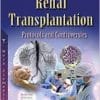 Pediatric Renal Transplantation: Protocols and Controversies