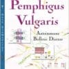 Pemphigus Vulgaris: Autoimmune Bullous Disease