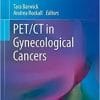 PET/CT in Gynecological Cancers (Clinicians’ Guides to Radionuclide Hybrid Imaging) 1st