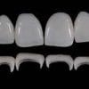Prosthetic Rehabilitation on Natural Teeth: Predictable, Esthetic and Systematic Steps