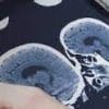 Neuroradiology Update 2016 – Online (CME VIDEOS)