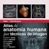 Weir y Abrahams. Atlas de anatomía humana por técnicas de imagen (Spanish Edition)