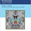 Estimulação Cerebral Profunda: Técnicas e Práticas (PDF)
