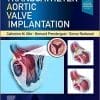 Transcatheter Aortic Valve Implantation (PDF)