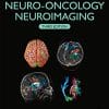 Handbook of Neuro-Oncology Neuroimaging, 3rd Edition (PDF)
