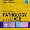 MacSween’s Pathology of the Liver, 8th Edition (EPUB)