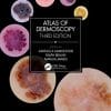 Atlas of Dermoscopy: Third Edition (EPUB)