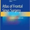 Atlas of Frontal Sinus Surgery: A Comprehensive Surgical Guide (EPUB)
