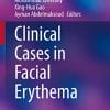 Clinical Cases in Facial Erythema (Clinical Cases in Dermatology) (EPUB)