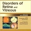 Disorders of Retina and Vitreous (Modern System of Ophthalmology (MSO) Series) (PDF)
