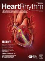 Heart Rhythm: Volume 17 (Issue 1 to Issue 12) 2020 PDF