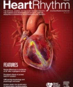 Heart Rhythm: Volume 18 (Issue 1 to Issue 12) 2021 PDF