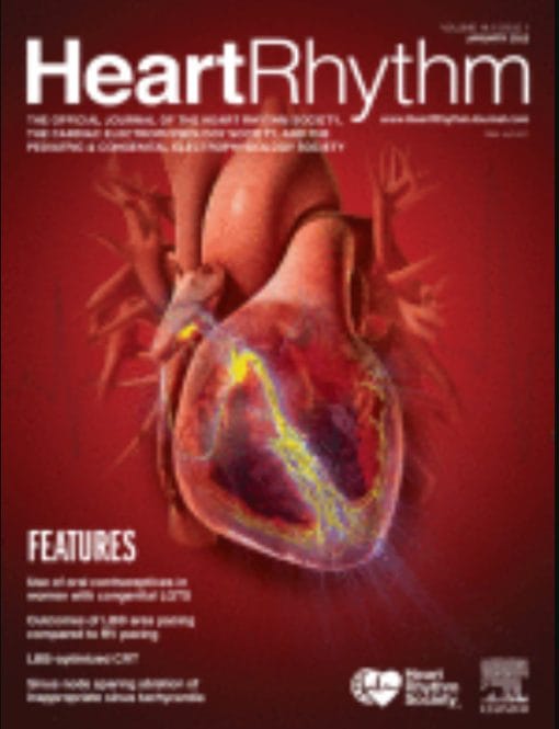 Heart Rhythm: Volume 19 (Issue 1 to Issue 12) 2022 PDF