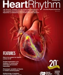 Heart Rhythm: Volume 20 (Issue 1 to Issue 12) 2023 PDF