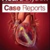 HeartRhythm Case Reports:  Volume 6 (Issue 1 to Issue 12) 2020 PDF