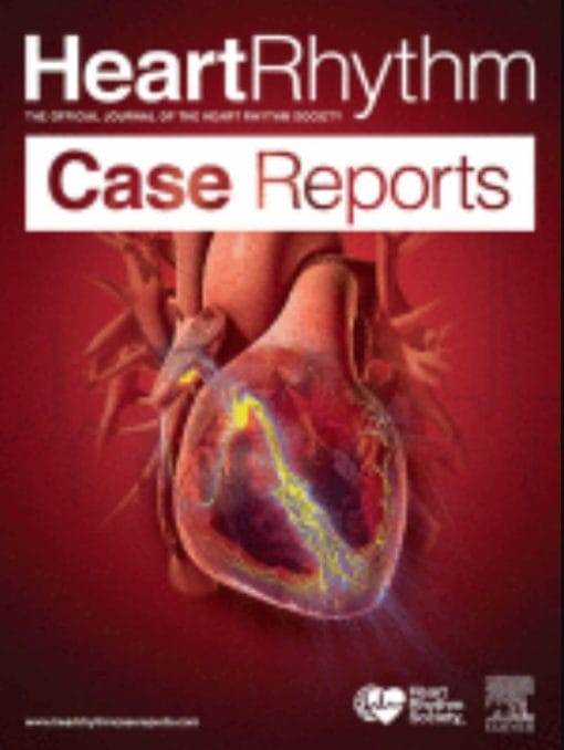 HeartRhythm Case Reports:  Volume 6 (Issue 1 to Issue 12) 2020 PDF