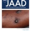 Journal of the American Academy of Dermatology: Volume 83 (Issue 1 to Issue 6) 2020 PDF