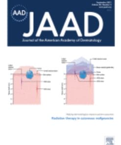 Journal of the American Academy of Dermatology: Volume 85 (Issue 1 to Issue 6) 2021 PDF