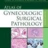 Atlas of Gynecologic Surgical Pathology, 2e