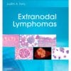 Extranodal Lymphomas: Expert Consult – Online and Print, 1e