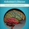 Genes, Environment and Alzheimer’s Disease