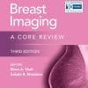 Breast Imaging (EPUB)