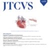 The Journal of Thoracic and Cardiovascular Surgery – Volume 164, Issue 5 2022 PDF