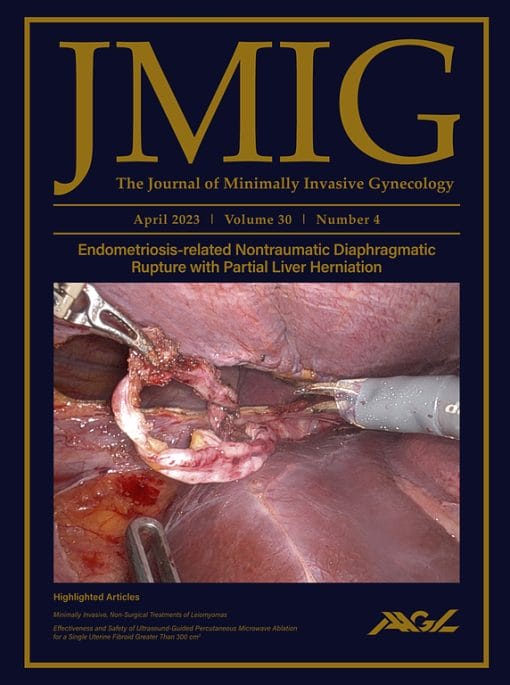 Journal of Minimally Invasive Gynecology: Volume 30 (Issue 1 to Issue 4) 2023 PDF