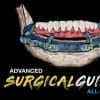 Implant Ninja, Advanced Surgical Guides – All on X – Dental Videos
